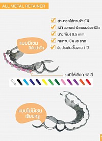 รีเทนเนอร์โลหะ